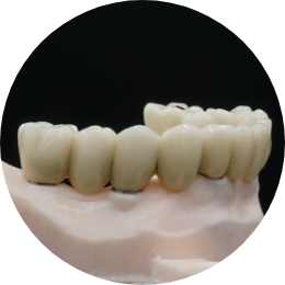 Immagine Protesi a carico immediato