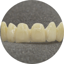 Immagine Protesi su monconi naturali